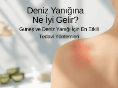 Deniz Yanığına Ne İyi Gelir? | Güneş ve Deniz Yanığı İçin En Etkili Tedavi Yöntemleri