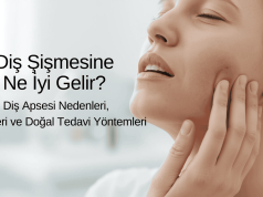 Diş Şişmesine Ne İyi Gelir? | Diş Apsesi Nedenleri, Belirtileri ve Doğal Tedavi Yöntemleri