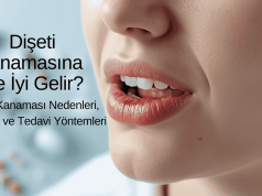 Dişeti Kanamasına Ne İyi Gelir? | Dişeti Kanaması Nedenleri, Belirtileri ve Tedavi Yöntemleri