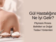 🌹 Gül Hastalığına Ne İyi Gelir? | Pityriasis Rosea Belirtileri ve Doğal Tedavi Yöntemleri
