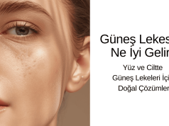 ☀️ Güneş Lekesine Ne İyi Gelir? | Yüz ve Ciltte Güneş Lekeleri İçin Doğal Çözümler