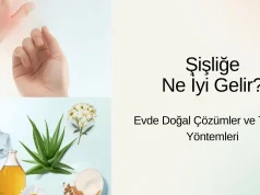 Şişliğe Ne İyi Gelir? 💥 Evde Çözümler